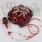 Bleeding Intestines