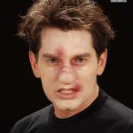 Broken Noses