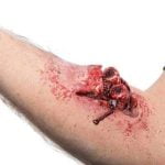 Compound Fracture Prosthetic