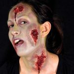 Oozing Wounds