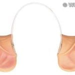 Pig Ears