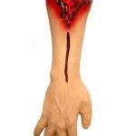 Severed Arm