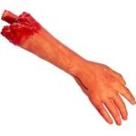 Severed Arm